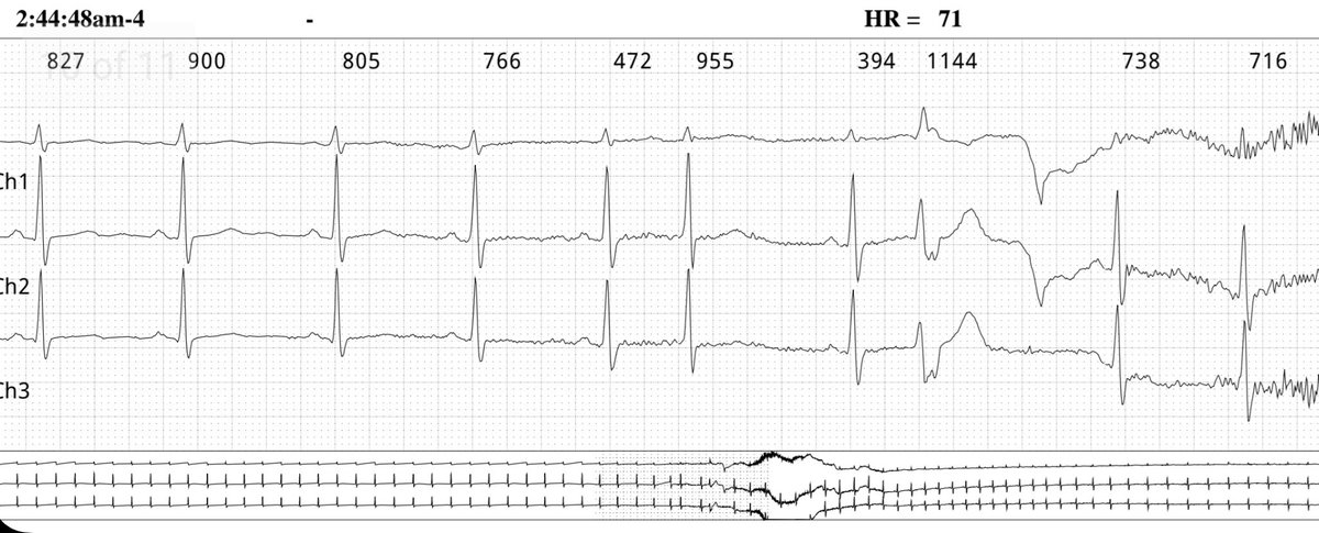 Electrophysiology tweet media