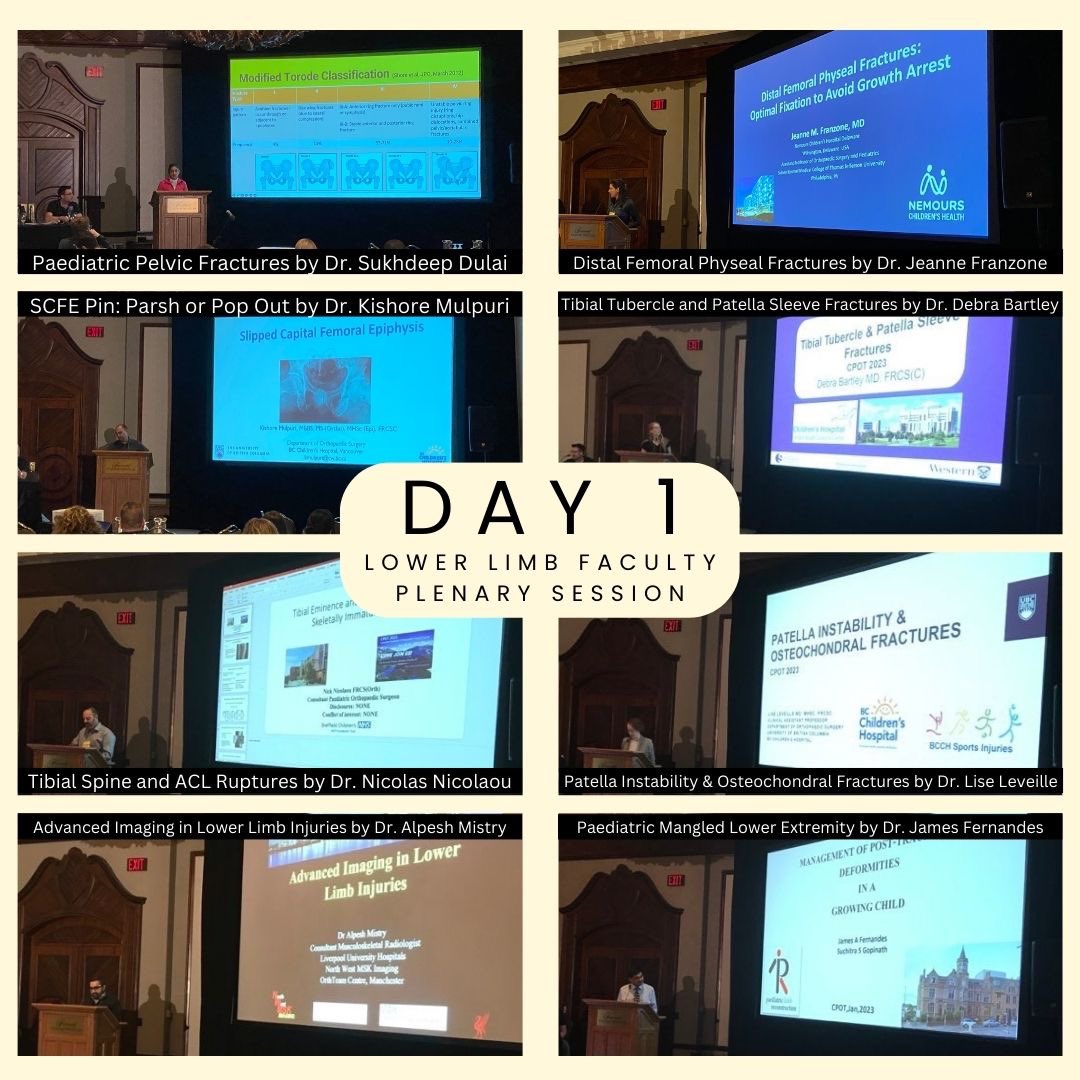 cpotcourse's tweet photo. Thank you to everyone involved with the Canadian Paediatric Orthopaedic Trauma Course for 2023! It was incredible seeing everyone in person again in Whistler, and this gathering of health professionals passionate about paediatric orthopaedics is extraordinary. 😄
(1/3) https://t.co/uGDEIYVDNx