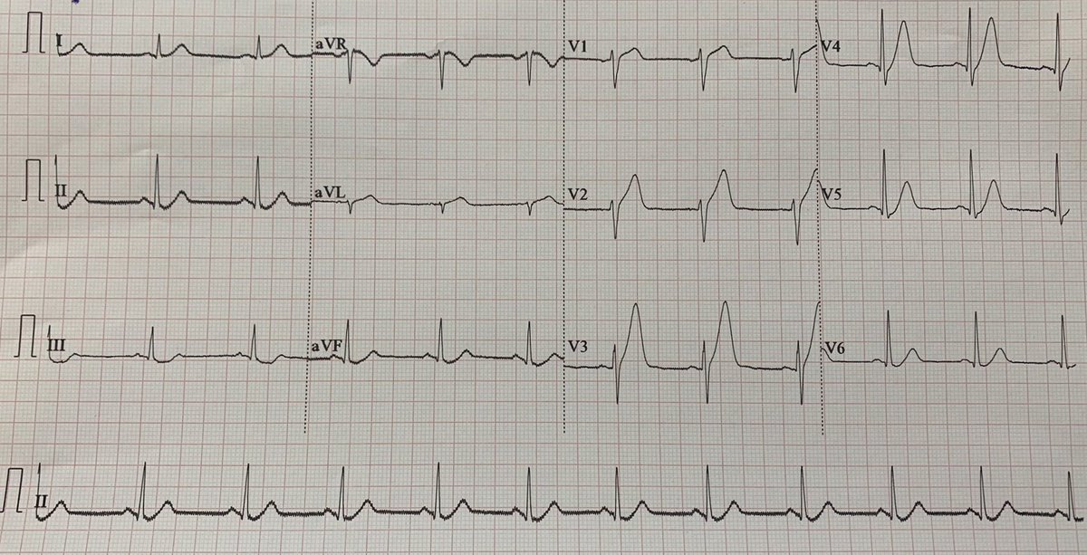 Chest pain

DX ?