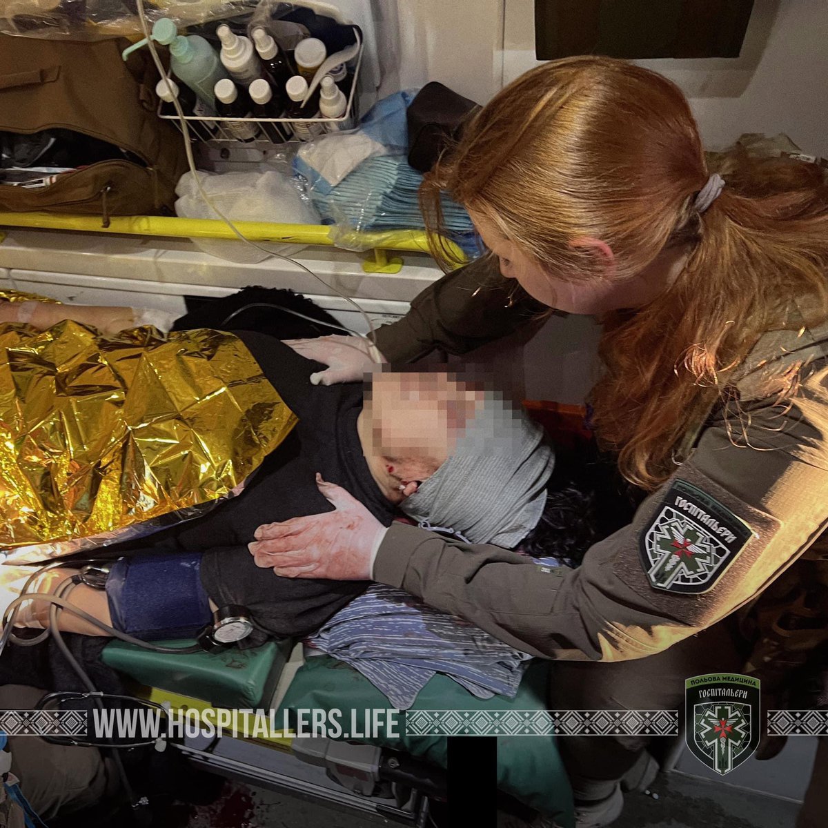 Вони стояли на зупинці біля Коксохіму в Авдіївці. Коли туди прилетів снаряд.

В лікарні, куди нас викликали, на підлозі лежали тіла цивільних. На каталках - ледве притомні поранені. Багато крові. Присмак металу. Запах не свіжого м’яса.

40 хвилин везли жінку до госпіталю.