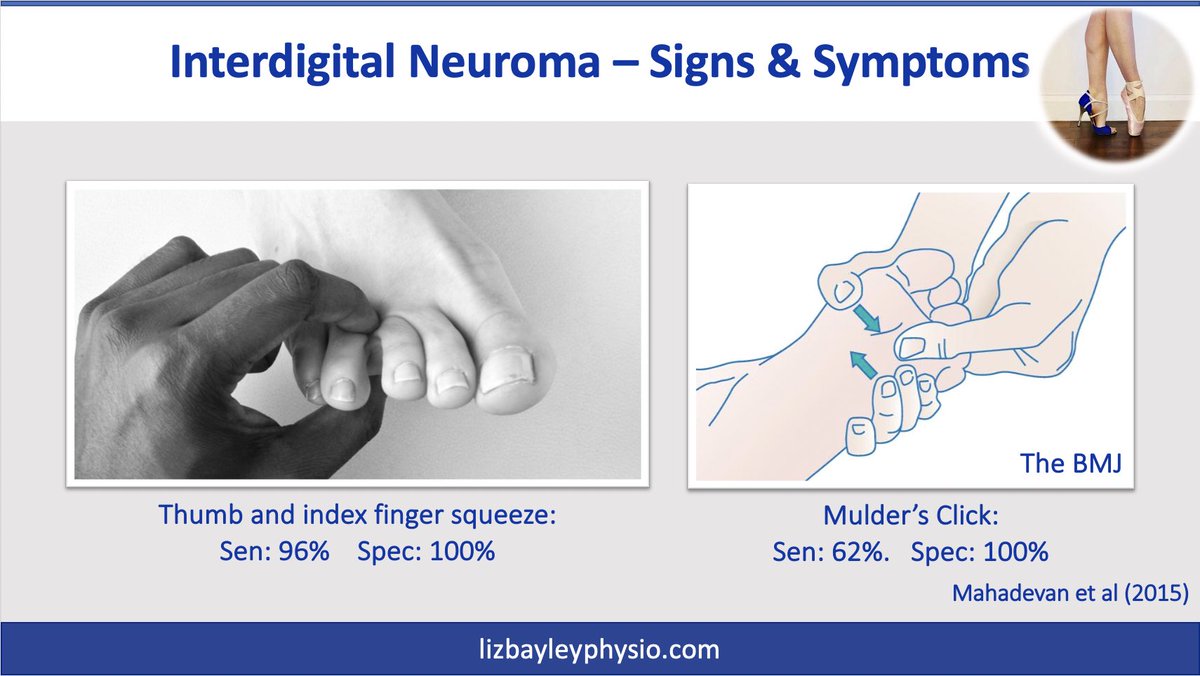lizbayleyphysio's tweet photo. This Saturday join myself, @gui_tran + @emarlow89 for a morning of foot & ankle. I’ll be covering diagnosis & differentials of common forefoot presentations inc #neuromas👇🏼 I’ll explore how conditions interlink & discuss best practice management🦶🏼
Book 👉🏼 https://t.co/Y3fxib3RQr https://t.co/jQrszsEh6M