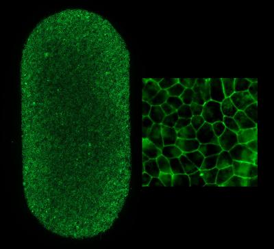 NatEyeInstitute's tweet photo. A clinical trial launched testing an autologous stem cell surgery for dry age-related #MacularDegeneration (AMD) — a leading cause of vision loss among older people in the U.S.: https://t.co/GtKzYk2Ptt 
#NEIResearchNews https://t.co/XIS4O4hUgV