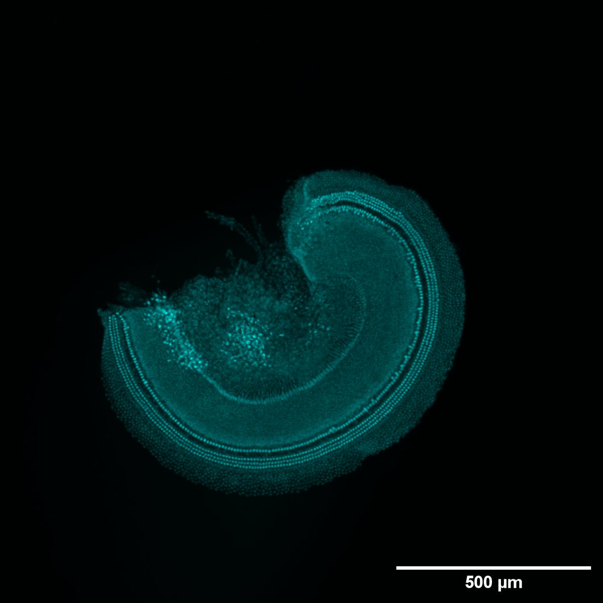 HearingShef's tweet photo. Enjoy this image of the cochlea of a young mouse which has labelling of a marker for DNA damage.
The brighter dots in the second image show where the damage is specifically occurring, very cool! #FluorescentFriday https://t.co/qrzslqSCJ1