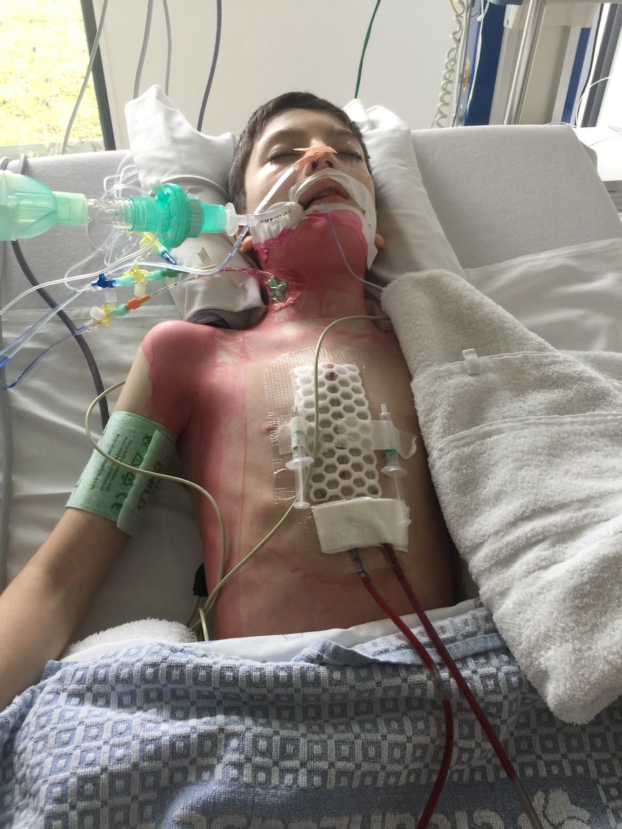 koen_vermang's tweet photo. @KAAGent Is dat enkel op basis van de media aandacht? Er zijn veel van die kinderen …. Maar alle respect dat hij er door kwam! https://t.co/fc4t1GCE1G