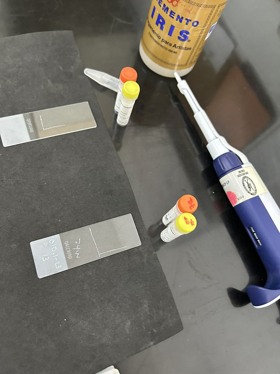 rodmorenoMD's tweet image. Hoy en el lab toca hacer FISH 🔬🧬para las regiones 22q11.2 y 7q11.23

¿Qué estamos sospechando en nuestros pacientes? 

#RareDiseaseDay #MolecularCytogenetics