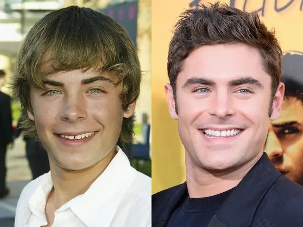 _bakedbeans's tweet image. wish i was living in the reality where zac kept his tooth gap