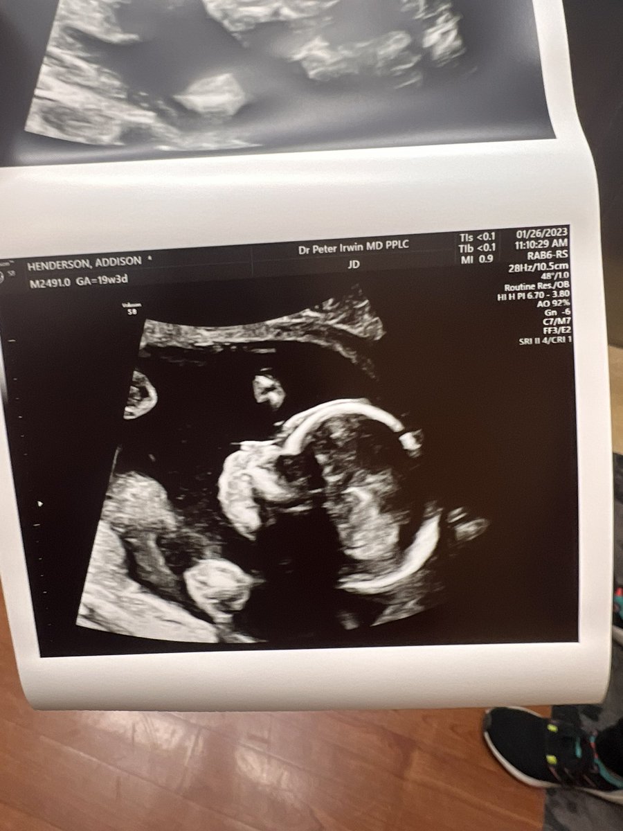 addsszz's tweet photo. It’s a GIRL 💜 
Little baby Isla 😭 https://t.co/QH8mh86gBf