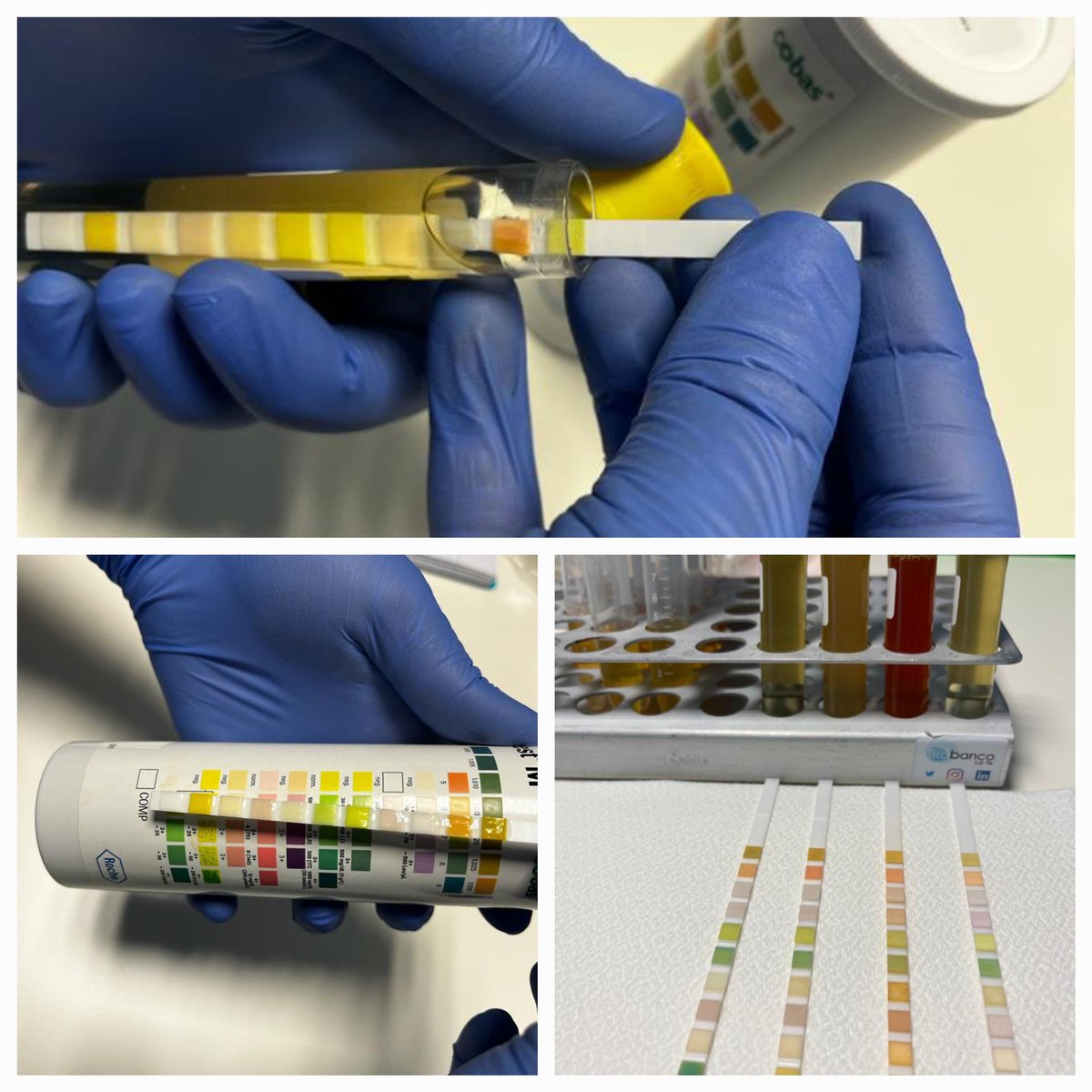 BiobancoLaFe's tweet image. #ControlCalidad🔎✅️📊

🟡 Todas las muestras de #orina son sometidas a #ControlesCalidad👌previa #conservación❄️

🟡 #ADN🧬#cfDNA🧬

🟡 Estudios #genómicos, #proteómicos y #metabolómicos

#SomosBiobancoLaFe👩‍🔬💯

@SJDbarcelona_es @AENOR @CirEsofago_LaFe @pilarnos @innotransfer