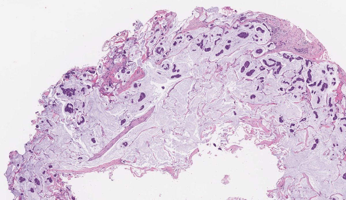 ihartpathology tweet picture