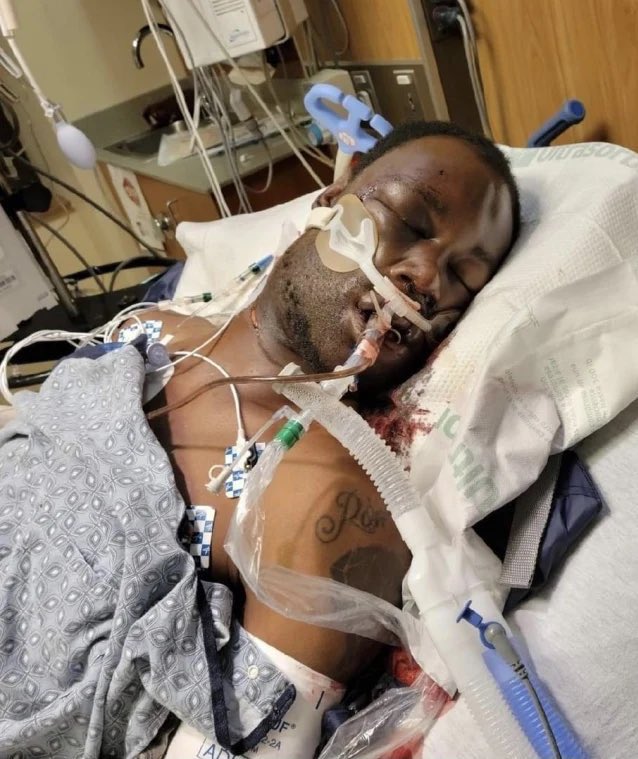 On Jan. 7th

29 y/o Tyre Nichols was assaulted by 5 cops during a traffic stop. He was beaten so badly that he died. 3 minutes of nonstop beating.

Luckily the cops who murdered were black and charged for murder in 2 weeks.

That wouldn’t have happened if these pigs were white.