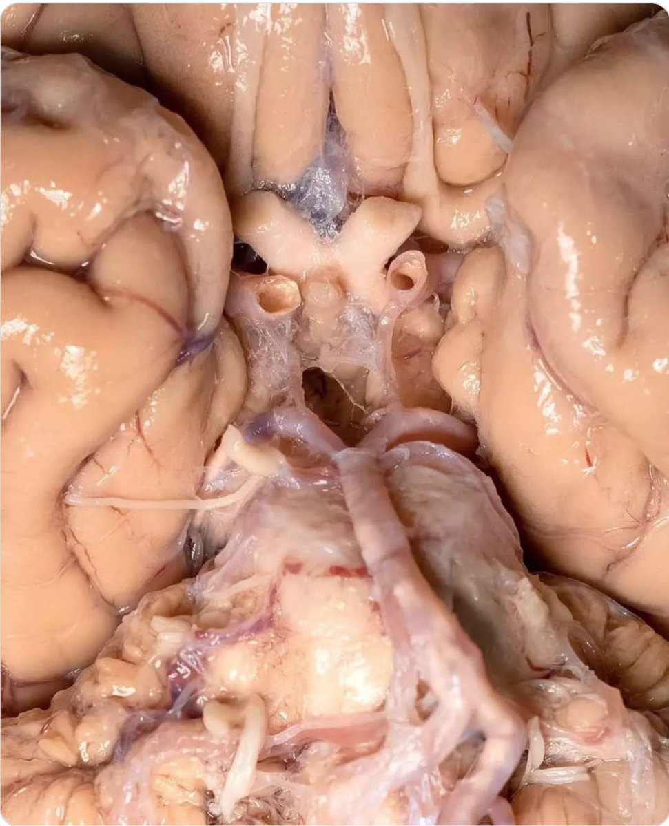 what structure did you see first?