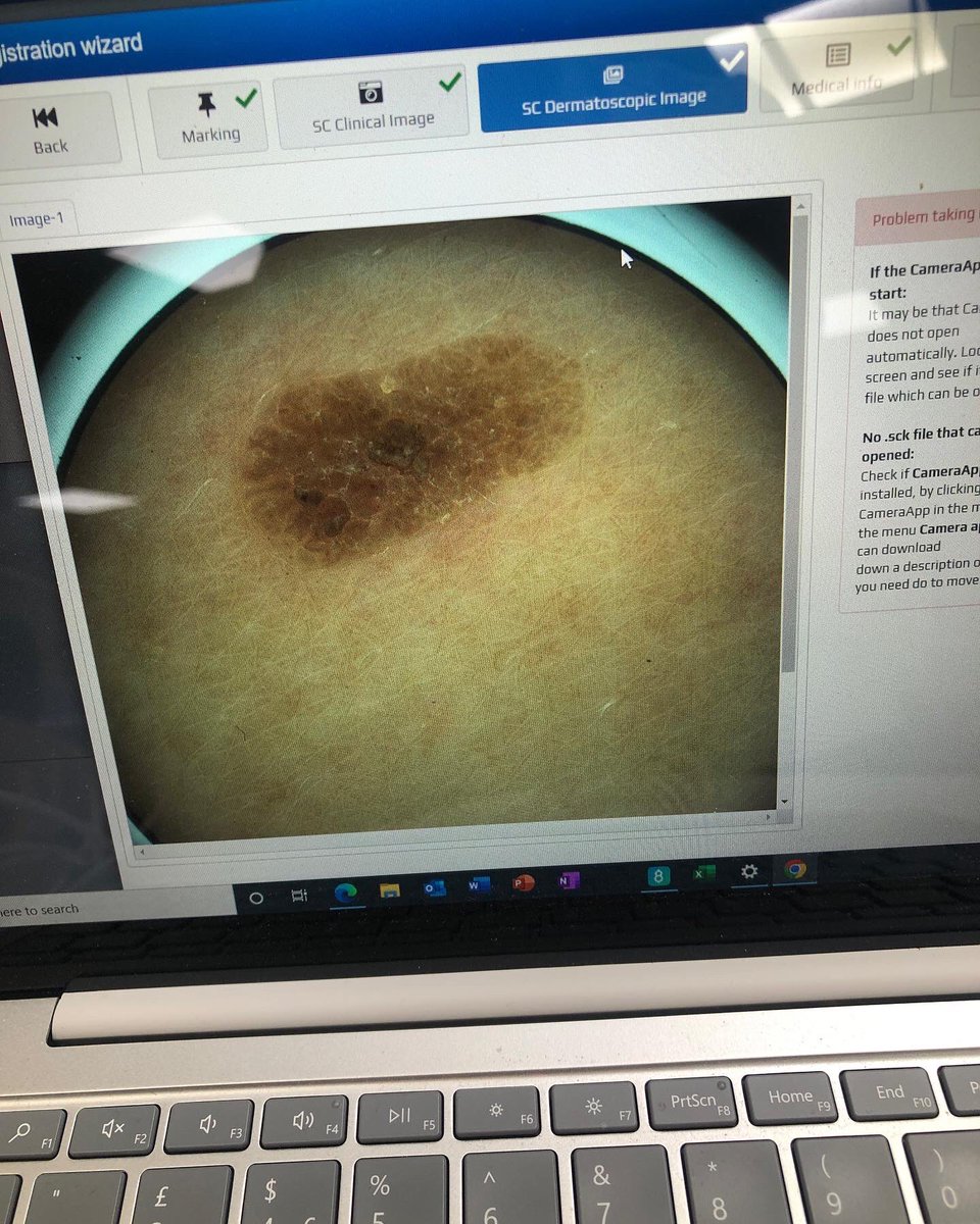ApexJacquie's tweet photo. Another day mole screening today at @GowerCollegeSwa as part of their staff wellbeing. Privileged to be invited back once again. Diolch. #staffwellbeing #molechecking #skincancerscreening https://t.co/ZHmqNZHm7g