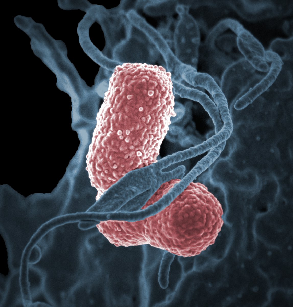 Les comparto esta noticia preocupante:

Por primera vez se detectó una superbacteria resistente a 30 antibióticos en pacientes de Argentina 

#arm #antibiotics 

🧵👇