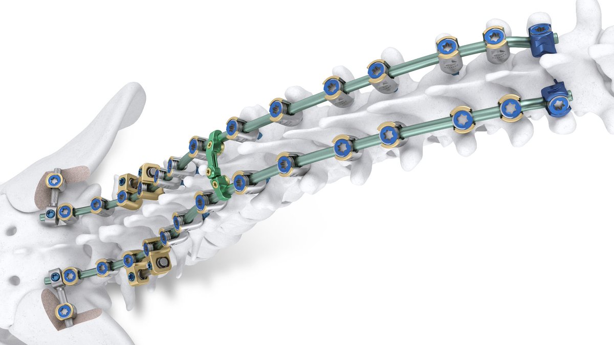 OrthofixMedical's tweet photo. In what is the first product launch following the merger of Orthofix and SeaSpine earlier this month, today we have announced the full commercial launch and first patient cases of the Mariner® Deformity Pedicle Screw System. https://t.co/NWYV1piKiy