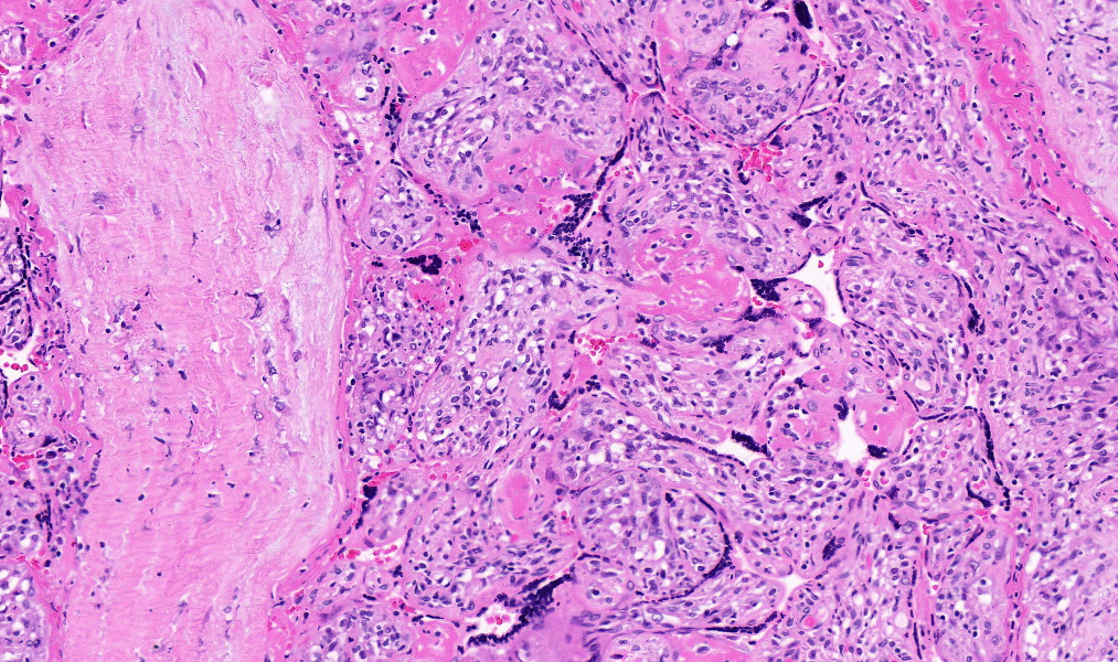 TristanRutland7's tweet image. Placenta

#Gynpath #IDpath #Pathtwitter #pathresidents