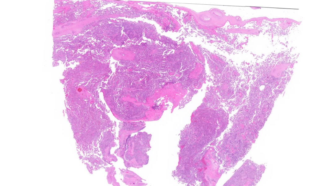 TristanRutland7's tweet image. Placenta

#Gynpath #IDpath #Pathtwitter #pathresidents