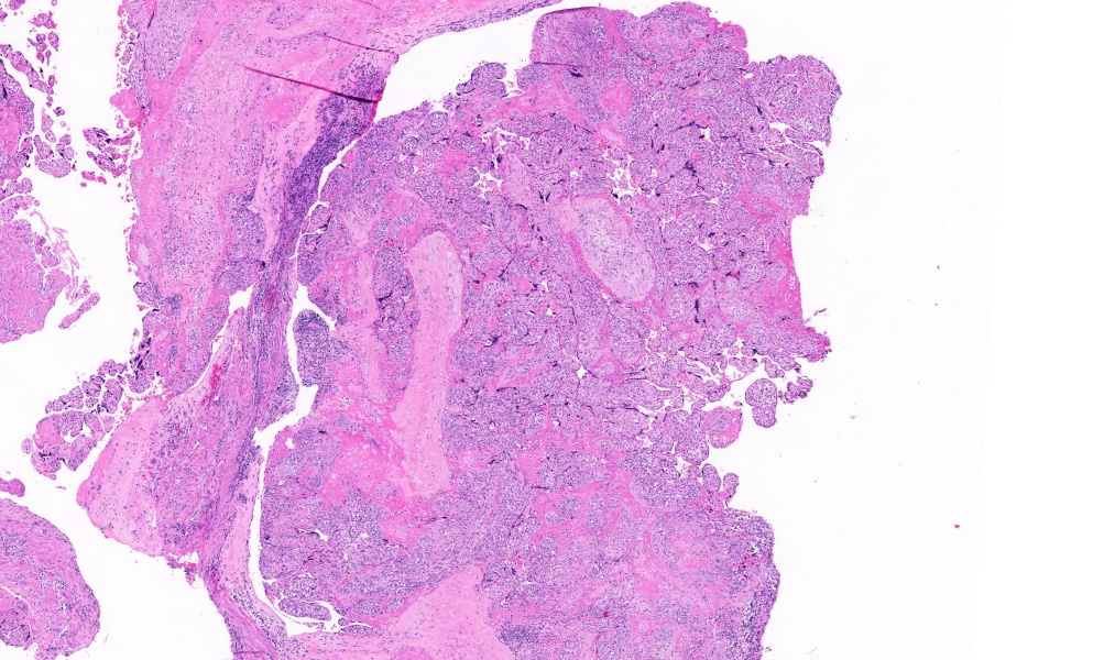 TristanRutland7's tweet image. Placenta

#Gynpath #IDpath #Pathtwitter #pathresidents