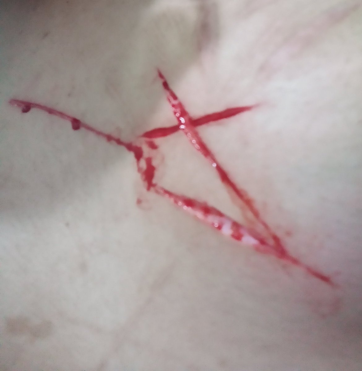 styrosking's tweet photo. not real, just fake!! 

I broke my 3 months of recovery sh 

🏷#shtwt #リスカ #リストカット #自伤 https://t.co/v47NX6GOM9