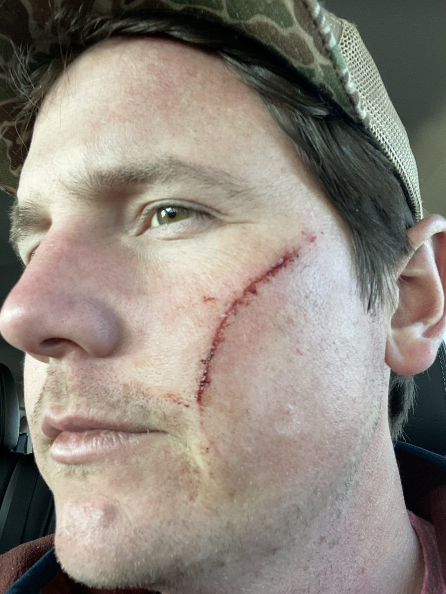 B_red26's tweet photo. Well this morning started off shity https://t.co/CcmH2JGrYZ