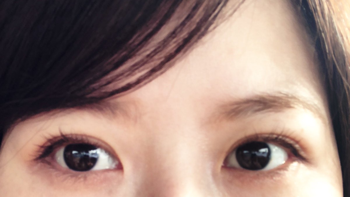 penpen___o's tweet photo. 埋没99日目
最近のメイクはアイシャドウ薄め、アイライン目尻のみ、マスカラはうぶ毛まで塗れる的なふさふさになるようなものを使ってます🍀*゜
#二重埋没 #札幌 https://t.co/yO7hpPIVjr