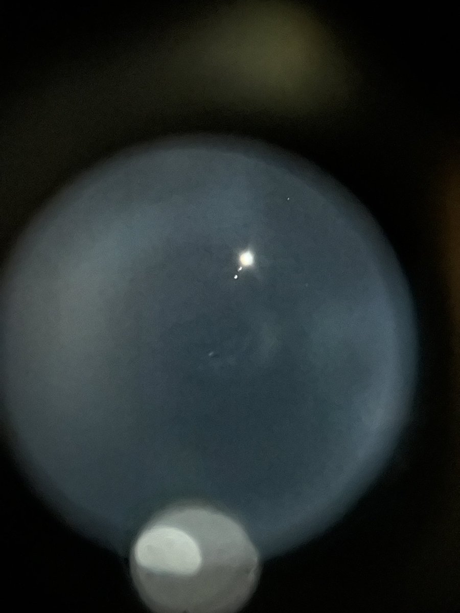 LorenaBolso's tweet photo. La Luna Por Peñarol y Jupiter que nos es esquivo… #BarrioPeñarol #Celestron #StarsenseExplorerLT no nos rendimos, ya dominaremos la técnica!! El mejor regalo de Navidad #GrandesyChicos https://t.co/zOPqCKWni5