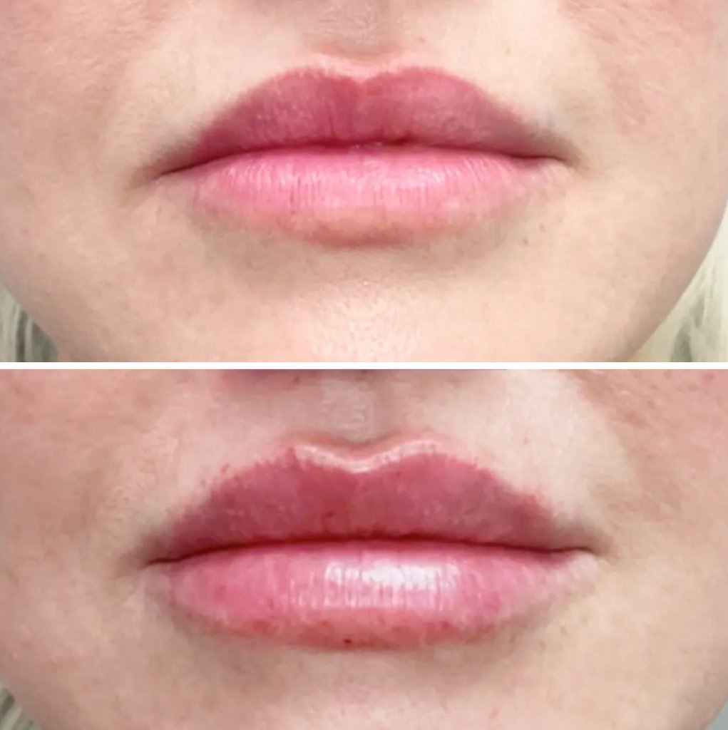 MD_Spa's tweet image. Contact us today:
Call: (780)9299797
Text: (780)9349021
DM: @MDSPALASER
Email: beaumont@mdspa.ca
Web: mdspa.ca

#edmonton #yeg #yeglocal #yegbusiness #alberta
#metime #beauty #wellness #selfcare #skin #acne #botox