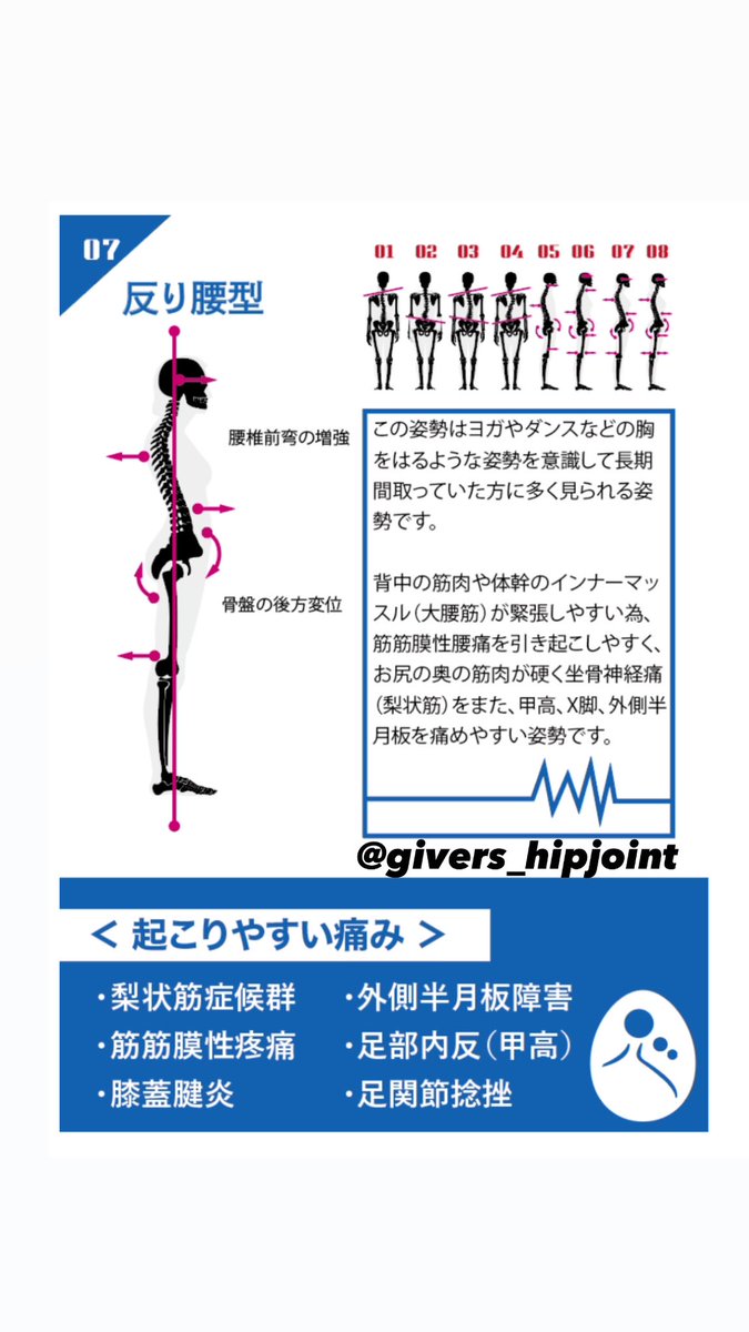 givers_hipjoint's tweet photo. @KAZNEe00 たしかに動かすべきところなど分かりにくいですよね_✍
鍛えるべき筋肉は姿勢のタイプによっても変わってくるのですが、
①猫背+反り腰のタイプ
→1,2枚目
②反り腰が強いタイプ
→3,4枚目
をオススメしています。
腹筋強化はまずやって頂きたいのがシンプルにプランクと呼ばれるものですね💡 https://t.co/D5lwMo3hGx