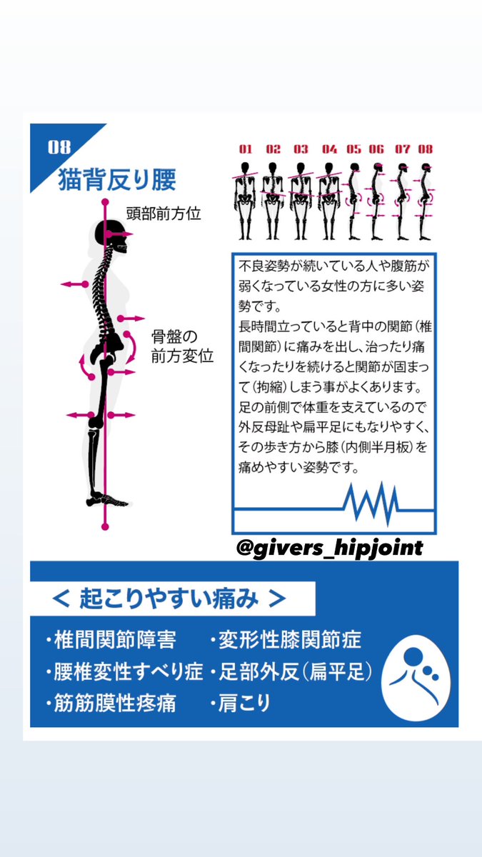givers_hipjoint's tweet photo. @KAZNEe00 たしかに動かすべきところなど分かりにくいですよね_✍
鍛えるべき筋肉は姿勢のタイプによっても変わってくるのですが、
①猫背+反り腰のタイプ
→1,2枚目
②反り腰が強いタイプ
→3,4枚目
をオススメしています。
腹筋強化はまずやって頂きたいのがシンプルにプランクと呼ばれるものですね💡 https://t.co/D5lwMo3hGx