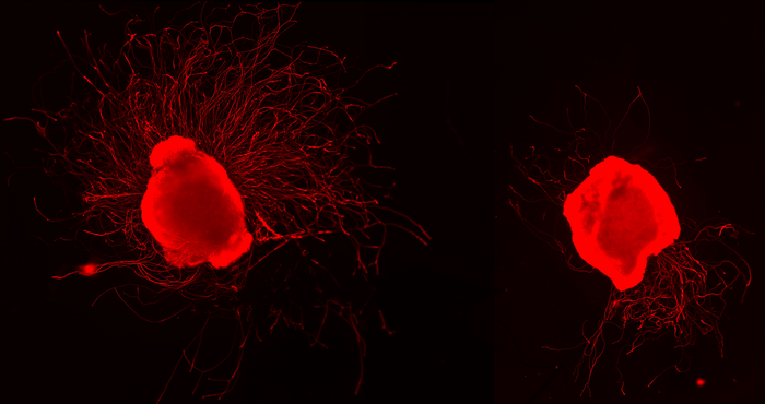 MulSclerosis's tweet photo. This could be a breakthrough for folks with multiple sclerosis. Propionic acid protects nerve cells and helps them regenerate – Patient Talk https://t.co/h0ShTTaaaL https://t.co/HxfQLODz6O