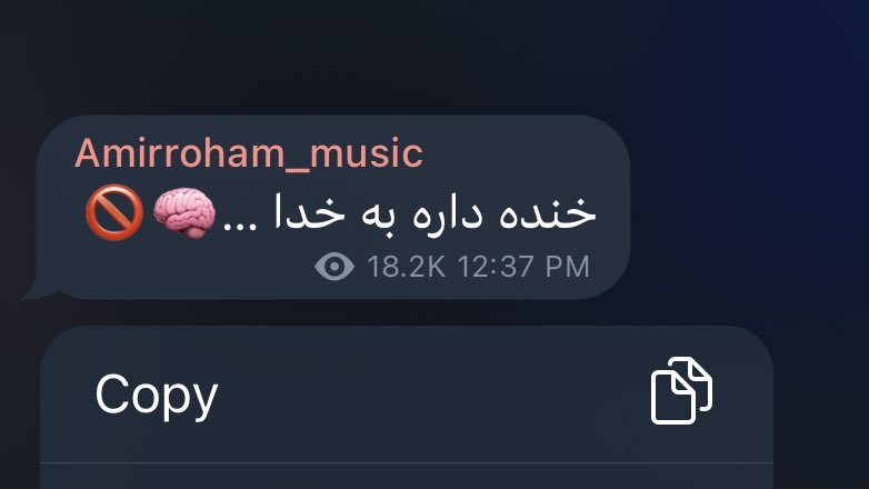 pishimoon78's tweet photo. حتی تصور اینکه با این حال بخوان رو استیج راه برن هم دردناکه چه برسه صدایی ازشون دربیاد.
#نه_به_کنسرت_اجباری 
#Mandatoryconcert https://t.co/5OgXA4IWTW