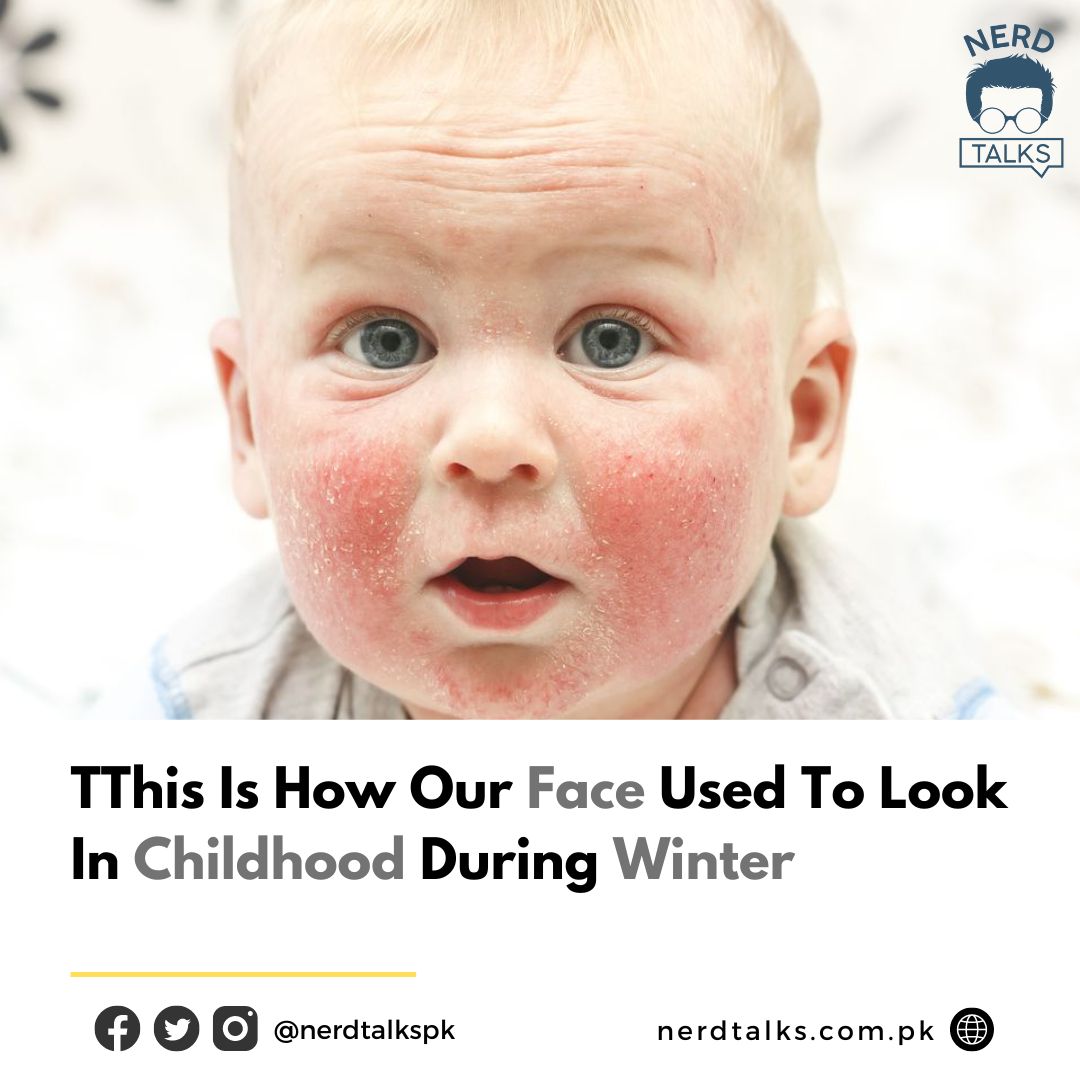 NerdTalkspk's tweet photo. Is how our face used to look in childhood during winter.
#SaniaMirza https://t.co/jDKE7JwFCv
