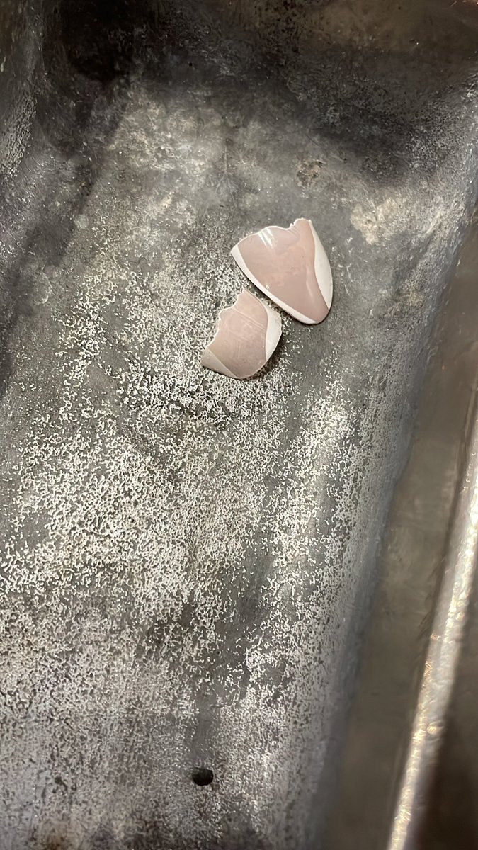 argaytha's tweet photo. What witchcraft should I do with @gildawabbit ‘s broken bowling nails? 🤔 https://t.co/c3a35YM2uo