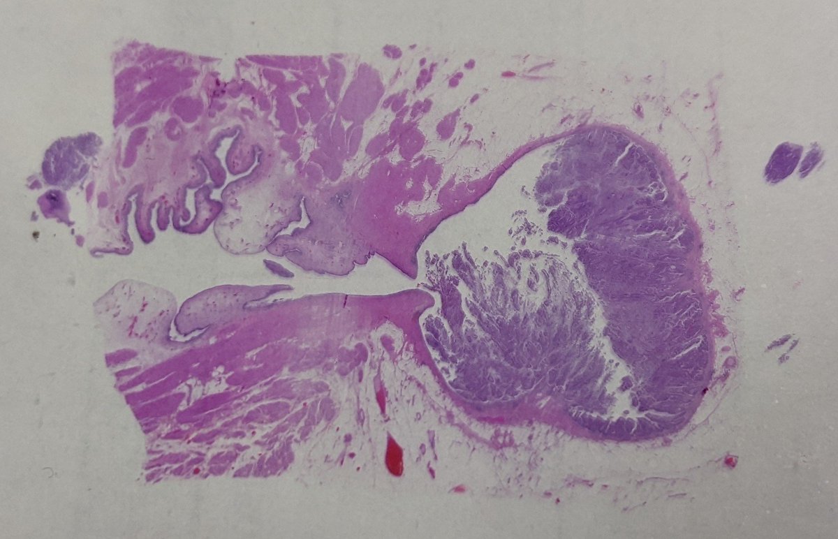 Bladder #GuPath