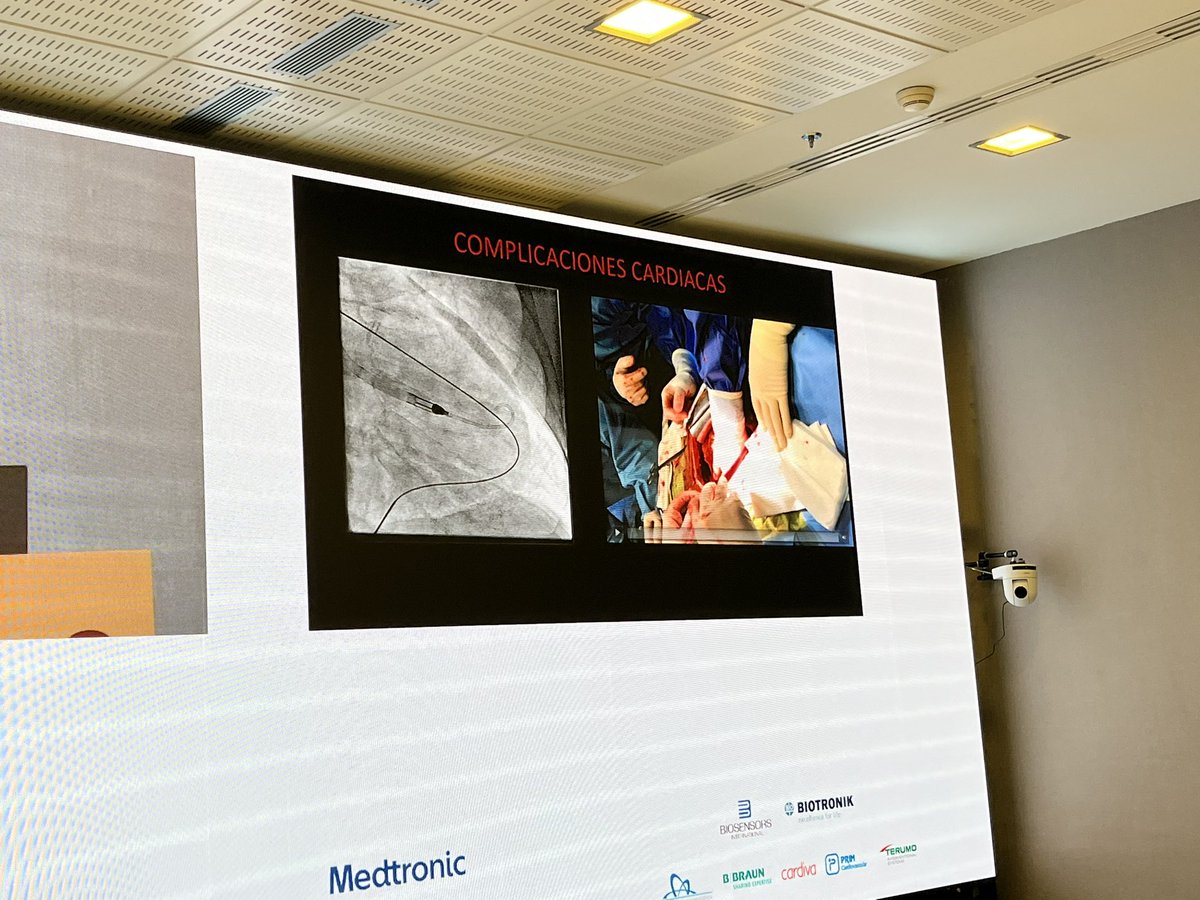 Javi Moreiras (@jmmoreiras) on Twitter photo Excelente controversia sobre el uso de dispositivos de asistencia en el contexto del paciente complejo entre <a href="/ignamatsant/">Ignacio J. Amat</a> y <a href="/rafa_romaguera/">Rafael Romaguera</a> Divertida, controvertida, completa y que ha generado debate en el #COMPLAC3. Tanto te preocupan las plaquetas, dice <a href="/pemarlor08/">Pedro Martín Lorenzo</a> ? Excelente controversia sobre el uso de dispositivos de asistencia en el contexto del paciente complejo entre <a href="/ignamatsant/">Ignacio J. Amat</a> y <a href="/rafa_romaguera/">Rafael Romaguera</a> Divertida, controvertida, completa y que ha generado debate en el #COMPLAC3. Tanto te preocupan las plaquetas, dice <a href="/pemarlor08/">Pedro Martín Lorenzo</a> ?