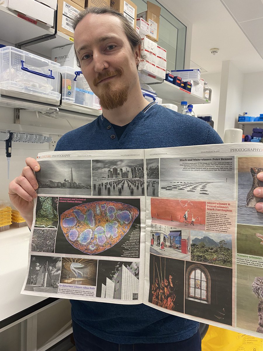 @ClatworthyLab microscopy is officially award winning! Congrats to Nathan Richoz! Spleen microscopy wins the local Cam science photography prize 🥳 🎉