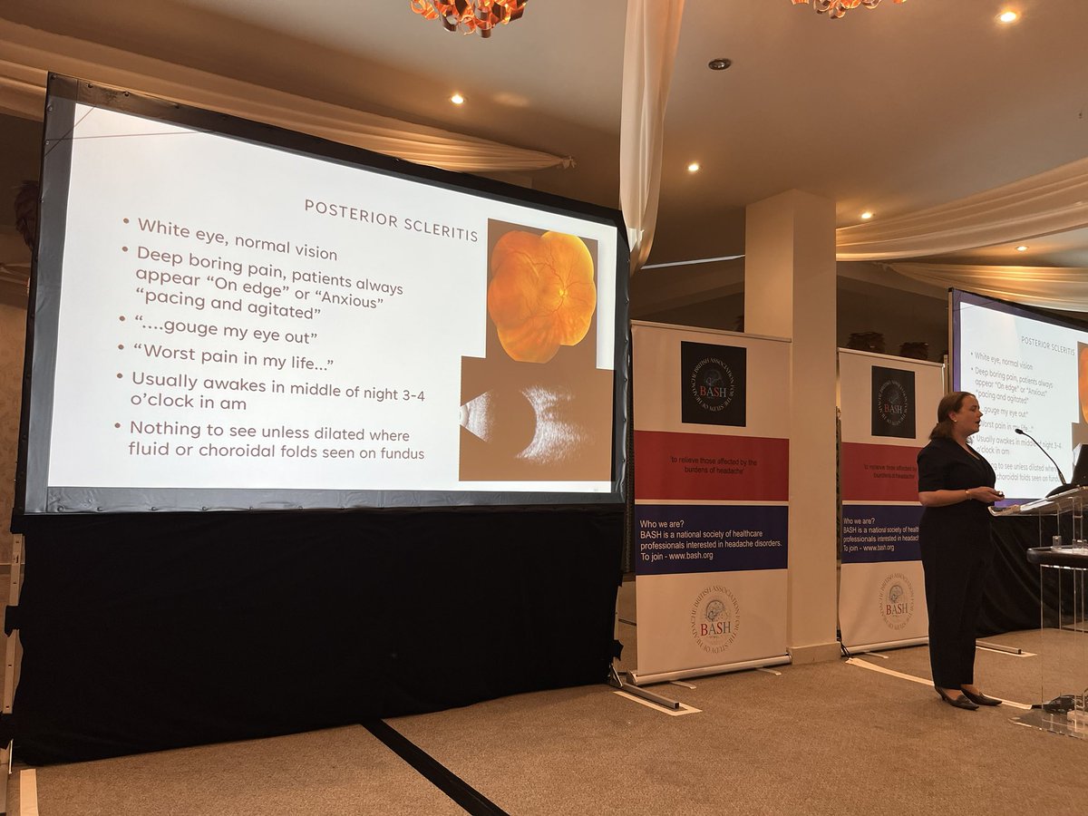 Headache meeting in Hull #BASH2023 <a href="/DrMollan/">Dr Susan Mollan</a> differential of alarm clock headache —&gt; posterior scleritis presents with severe eye pain + waking at night 👉ocular emergency <a href="/UK_headache/">BASH</a> <a href="/ihs_official/">International Headache Society</a> <a href="/ABNTrainees/">Neurology Trainees</a>