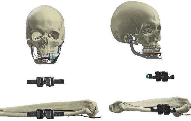 osteobionix tweet media