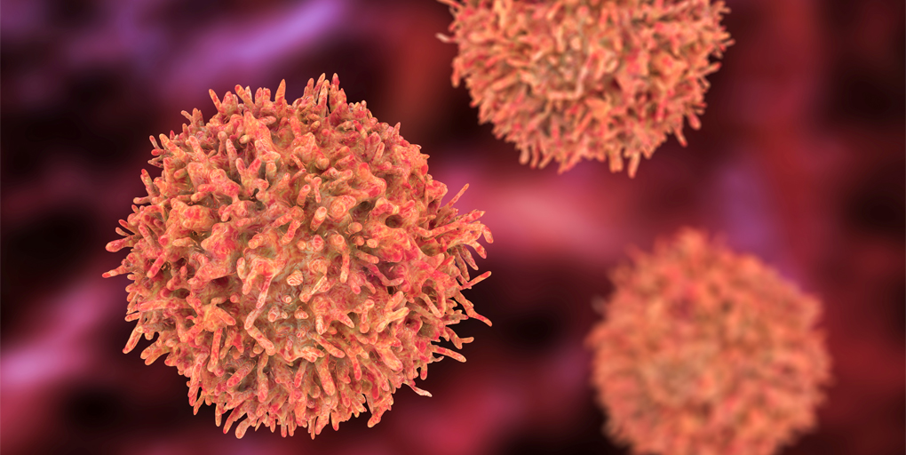 Cancer Discovery (@cd_aacr) on Twitter photo Read this week's Cancer Discovery #ResearchWatch:
Mutations in BTG1 Promote Germinal Center #Bcell Malignant Transformation, a summary of the paper by @coraline_mly, <a href="/LabMelnick/">Melnick Lab</a> et al.
bit.ly/3XKybgL
<a href="/WeillCornell/">Weill Cornell Medicine</a> Read this week's Cancer Discovery #ResearchWatch:
Mutations in BTG1 Promote Germinal Center #Bcell Malignant Transformation, a summary of the paper by @coraline_mly, <a href="/LabMelnick/">Melnick Lab</a> et al.
bit.ly/3XKybgL
<a href="/WeillCornell/">Weill Cornell Medicine</a>