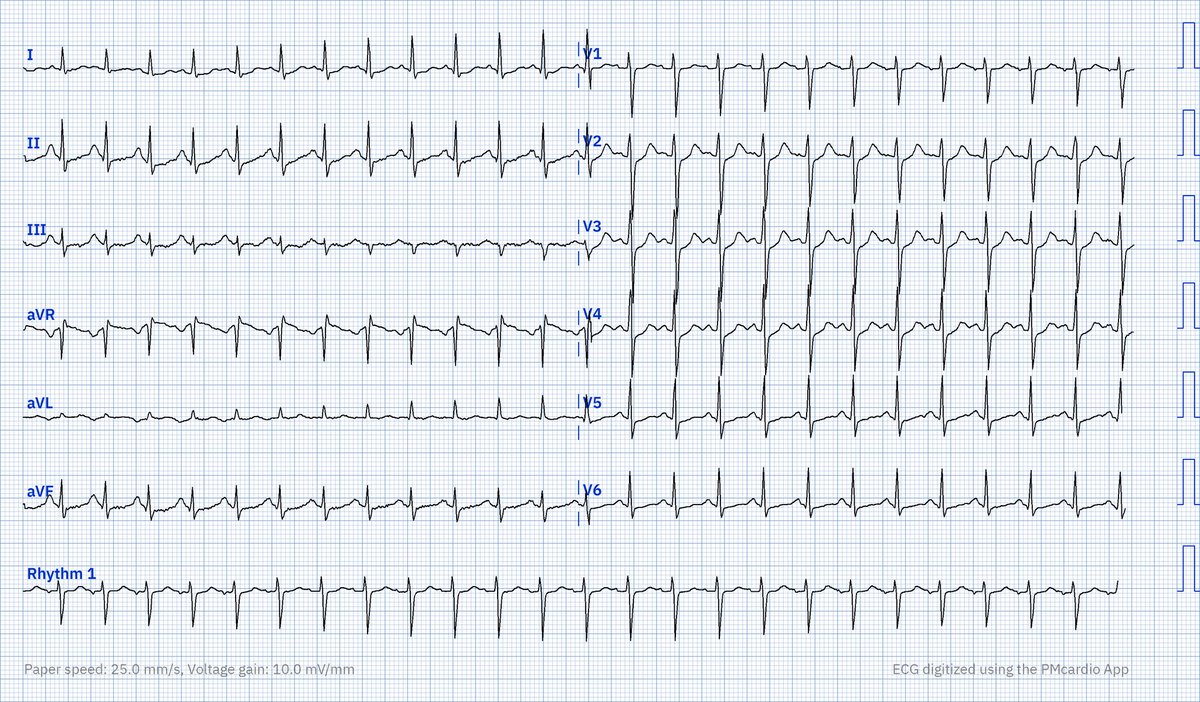 Electrophysiology tweet media