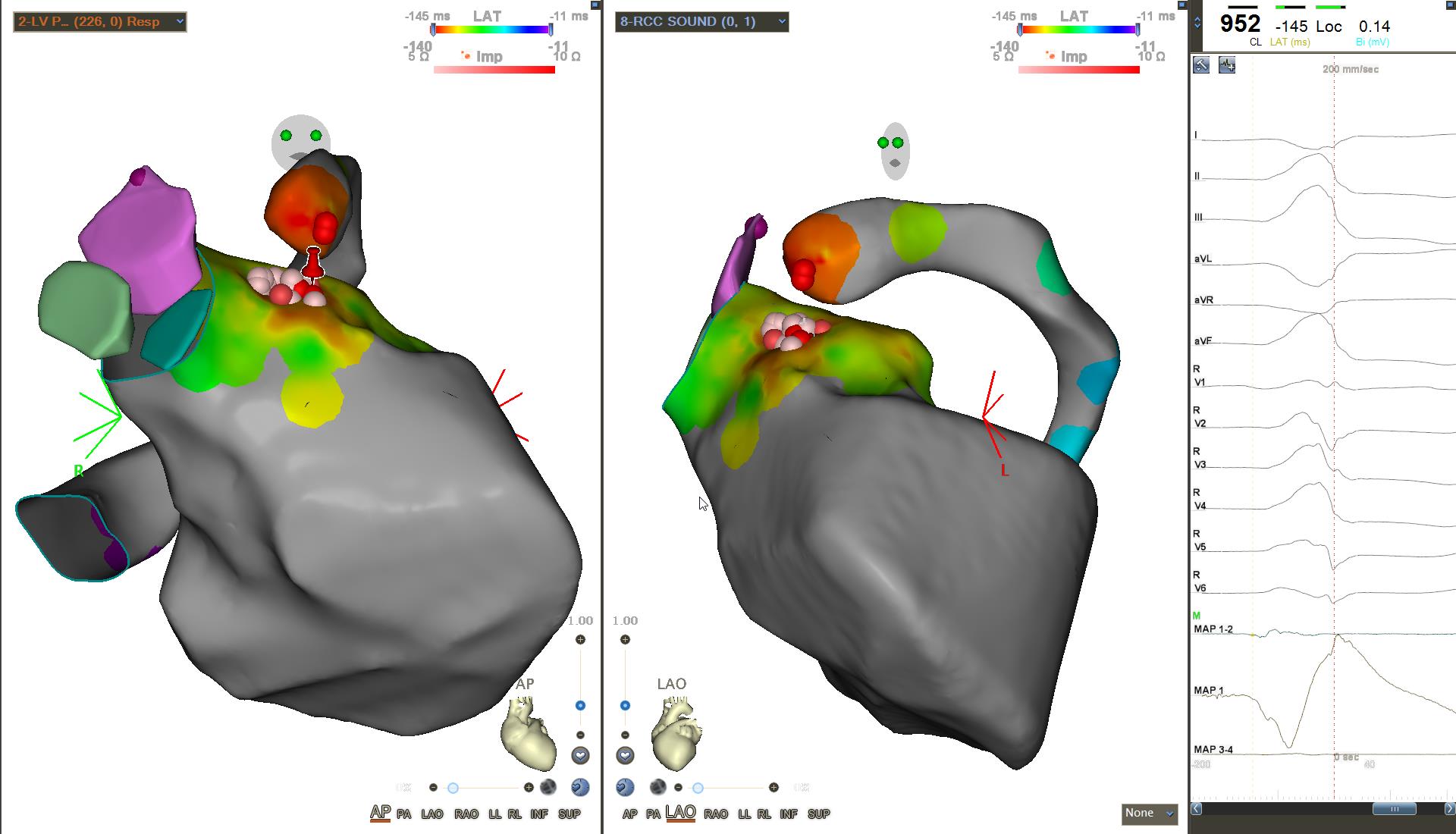 Chris Cheung on Twitter "LV Summit PVC cases always tricky... half