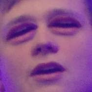 Vinno 🤙 tweet media