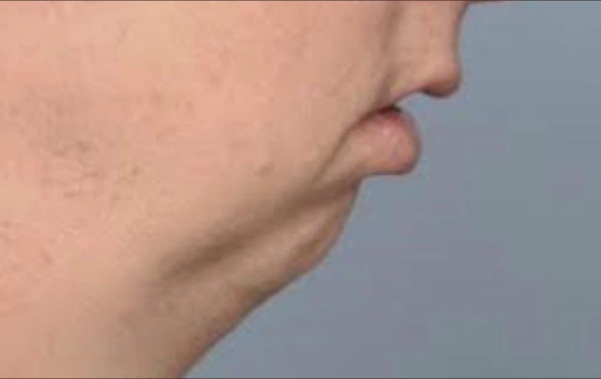 Billy Hartford tweet media