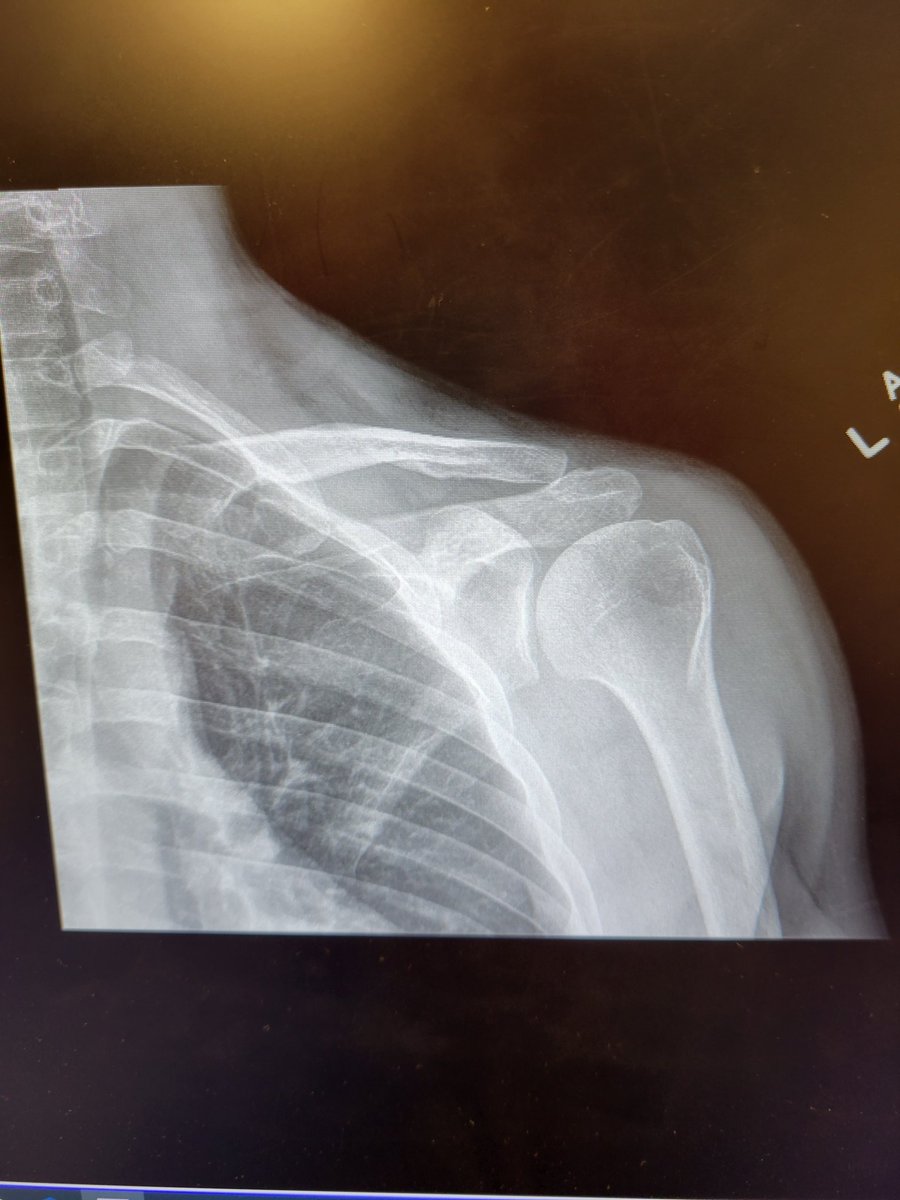 Well here comes another mri. Nothing good for 2023 so far.