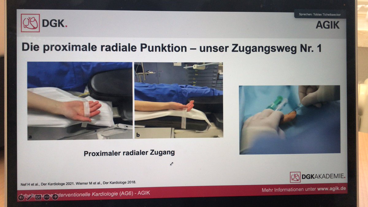 LPayoA's tweet photo. #radialisfirst Erste Schritte im Katheterlabor @SitaKhwaja @AGIKinterv https://t.co/tKz89fVJUz
