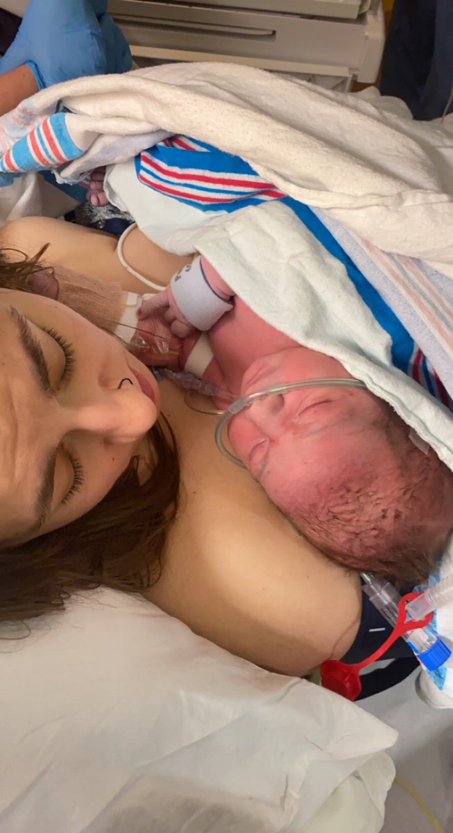 haileystarr224's tweet photo. I straight birthed a 10 pound baby and tore in every way possible. Got the epidural and still felt every single push for 4 hours but I will always have that knowledge that i did that with the help of the love of my life and i am a badass and my baby is so perfect https://t.co/WDM7Y8C5rW