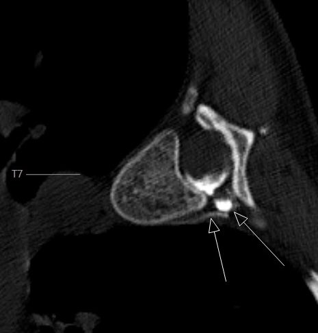 J. Levi Chazen MD tweet media