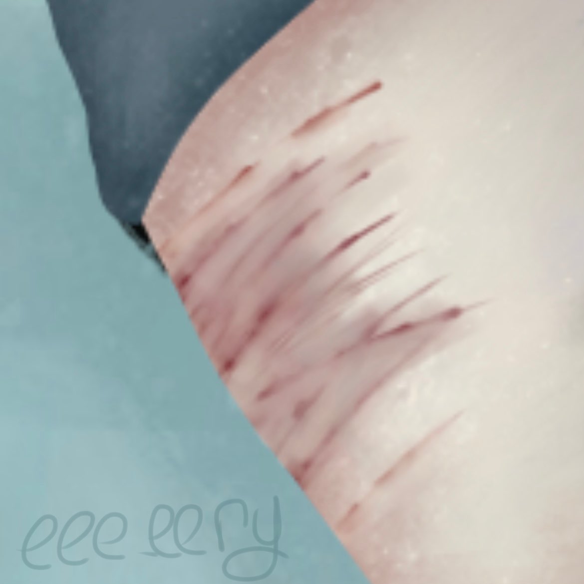 eee_eery's tweet photo. vent
#art #digitalart #ventart #vent #selfharmart https://t.co/hD3LmA43CF