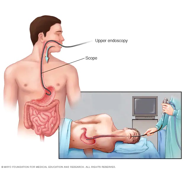 Mayo Clinic Comprehensive Cancer Center (@mayocancercare) on Twitter photo #EsophagealCancer is the sixth most common cause of cancer deaths worldwide. Our caring team of <a href="/MayoClinic/">Mayo Clinic</a> experts can help with your esophageal cancer-related health concerns. #CancerCare mayocl.in/3jhJG06 #EsophagealCancer is the sixth most common cause of cancer deaths worldwide. Our caring team of <a href="/MayoClinic/">Mayo Clinic</a> experts can help with your esophageal cancer-related health concerns. #CancerCare mayocl.in/3jhJG06