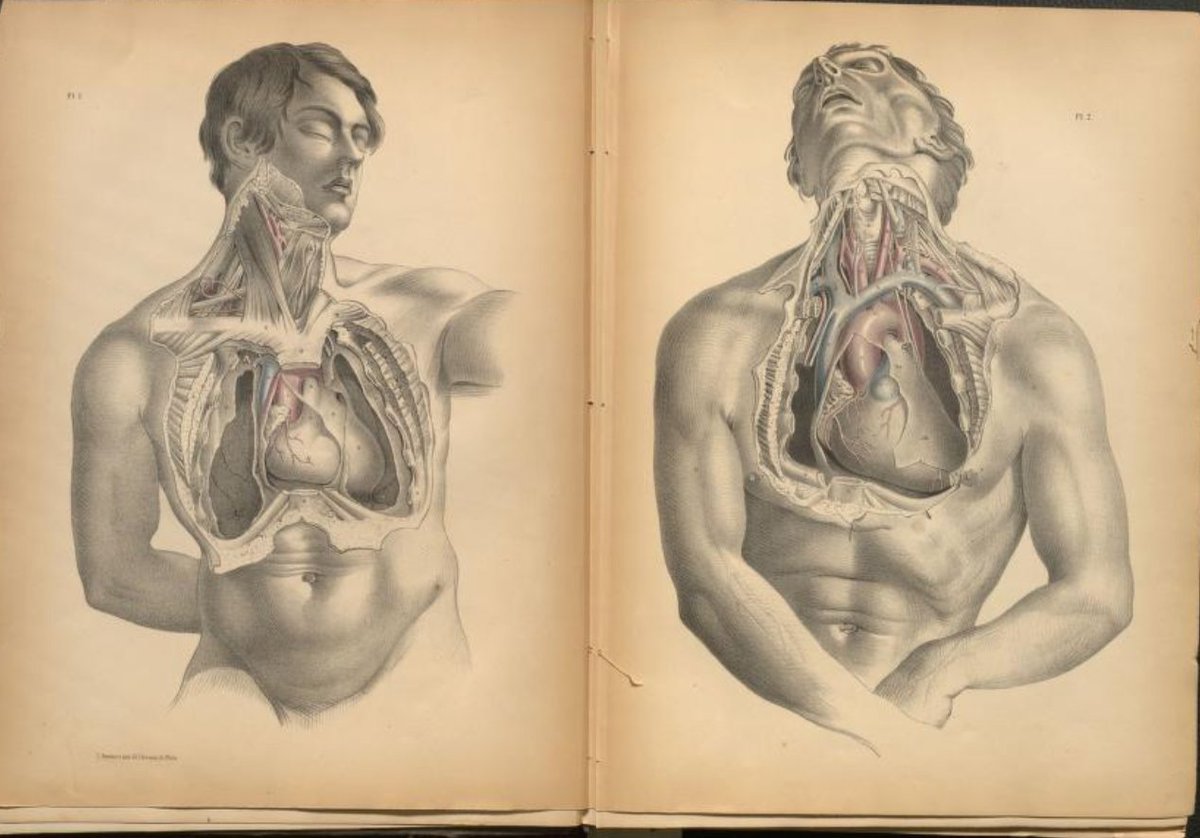 OslerLibrary's tweet photo. Check out the 1000th addition to our @internetarchive collection! Joseph Maclise's Surgical Anatomy, US version, 1851.
Examine this and other works here: https://t.co/M8uaumI9mT
Thanks to our colleagues in the digitization lab!
#NewlyDigitized #histmed https://t.co/jWbhwreDZV