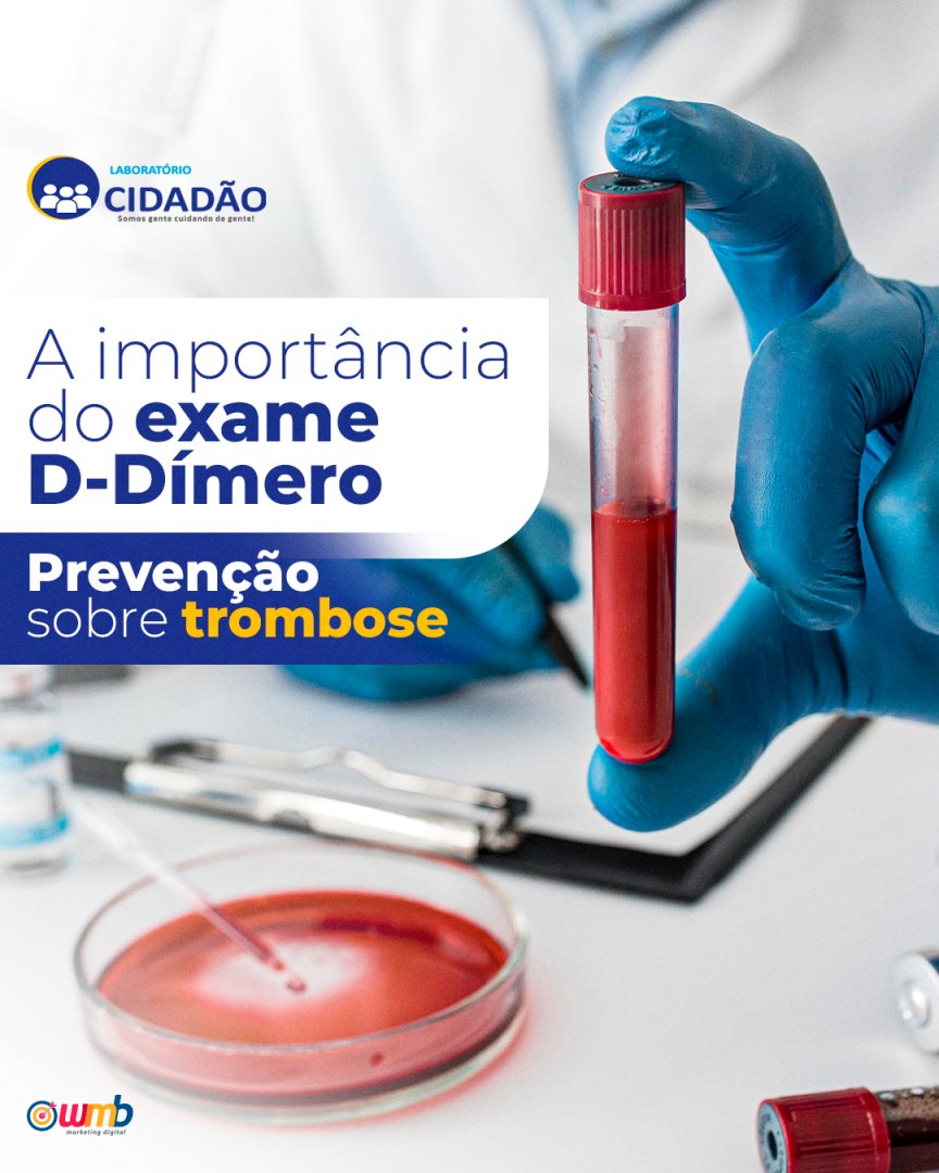 _wmbmarketing's tweet image. Exame mais que importante que  auxilia no diagnóstico ou para afastar a hipótese de doenças ou quadros trombóticos.

Confira post completo em: instagram.com/laboratoriocid…

#laboratório #exames #Trombose #Veias